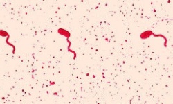 Flagella Stain
